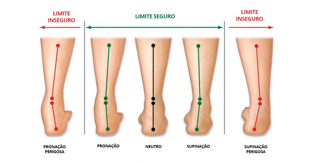 Tipos de Pisadas
